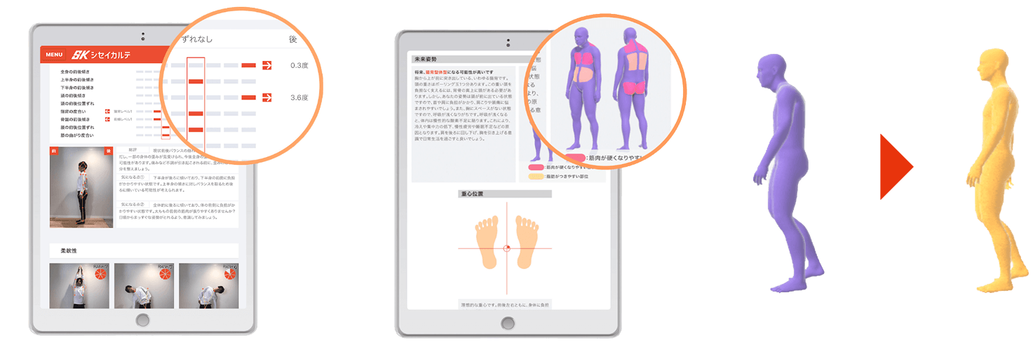 最新のAI姿勢分析システムで身体の状態を可視化